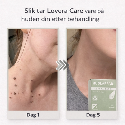 Lovera Care - Hudlapper