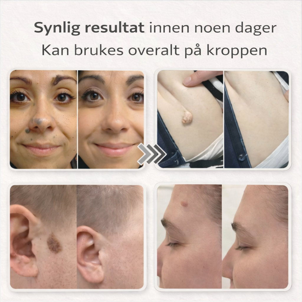 Lovera Care - Hudlapper